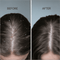 ScalpSense Dandruff  Shampoo & Conditioner Combo