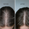 ScalpSense Dandruff Defense Shampoo
