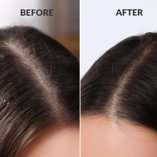 ScalpSense Hydra Soothe Shampoo