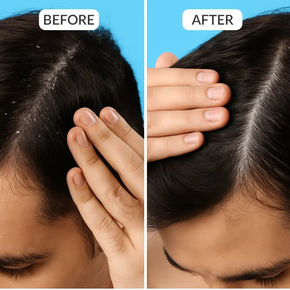 ScalpSense Hydra Soothe Vaccine