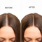 ScalpSense Hairfall Defense Shampoo
